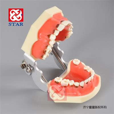 練習刮治縫合特點(diǎn)是3區6缺失牙齒牙齦可更換