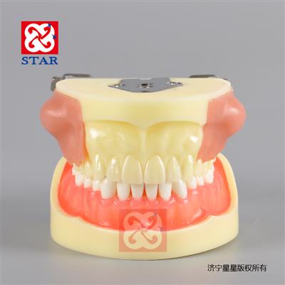 膿腫切開(kāi)引流雙側膿腫塊